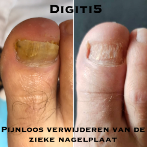 Digiti 5 Skincare Footcare Sugarwax | Galmaarden
